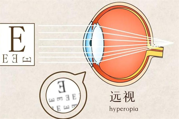 懷柔眼視力加盟