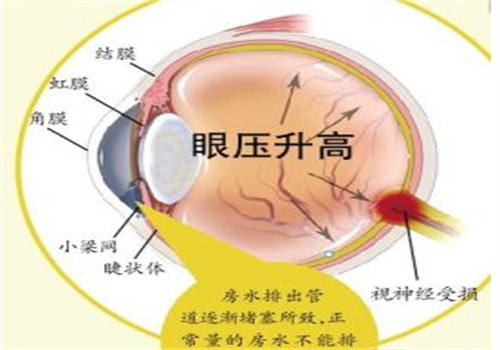 神瞳視力加盟